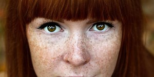 8 Skin Cancer Risk Factors That Might Surprise You