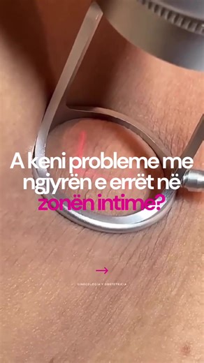 A keni vënë re që zona intime mund të bëhet më e errët se pjesët e tjera të trupit dhe me kalimin e kohës të humbasë elasticitetin, duke mos u dukur më aq e re dhe e lëmuar si më parë? Përveç Intima Laser, në Anaderm Clinic ofrojmë edhe laser për zbardhjen dhe rikthimin e ngjyrës natyrale rozë të zonës intime. Ky trajtim ndihmon në: ✨ zbardhjen e hiperpigmentimit në zonën intime ✨ stimulimin e kolagjenit për shtrëngim dhe rigjenerim të lëkurës ✨ përmirësimin e teksturës dhe rinimin e zonës intim