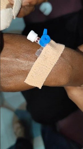 IV Cannulation technique procedure part 71 #shortvideo