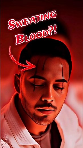 Hematidrosis: The Rare Condition That Makes You Sweat BLOOD