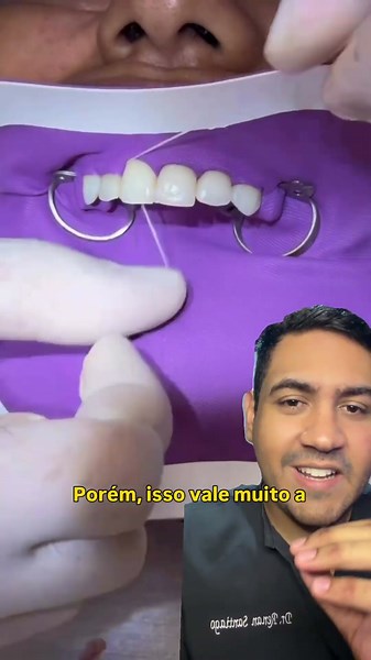 Isolation so your TOOTH can be the focus! #dentist #dentistry #shorts