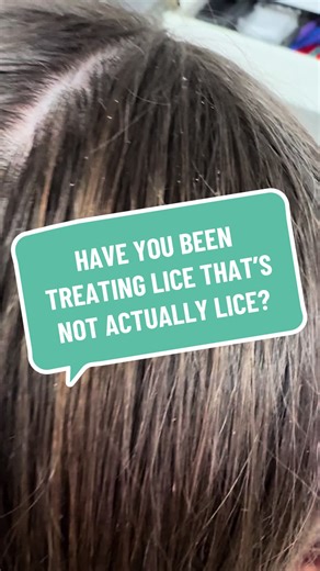 Identifying Waxy Buildup vs. Lice on Nits