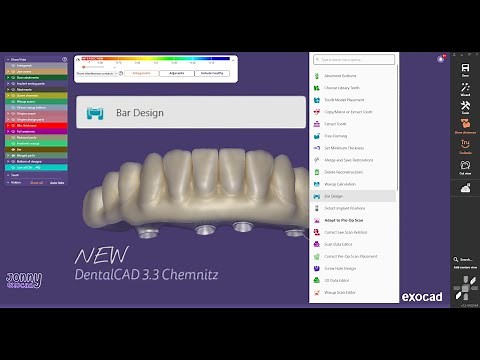 NEW Exocad 3.3 Bar Design Tutorial | Split Bar Workflow & Digital CAD Denture Framework