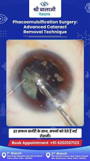 Experience clarity like never before with advanced Phacoemulsification Surgery.