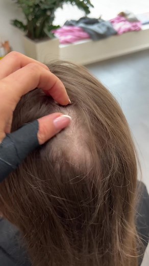 ODI EXTENSIONS on TikTok