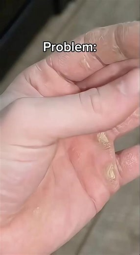 My problem and my solution