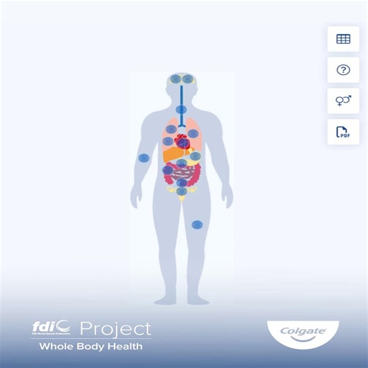 See how the mouth reveals the state of the whole body. 🦷 The upgraded Whole Body Health platform brings expanded, evidence-based content on systemic diseases with oral manifestations - including early signs, symptoms, and practical guidance for healthcare professionals. Designed to support integrated care, the platform helps dentists and other health professionals deliver better prevention, early detection, and patient outcomes. 👉 Explore the platform: https://whole-body-health.fdiworlddental.