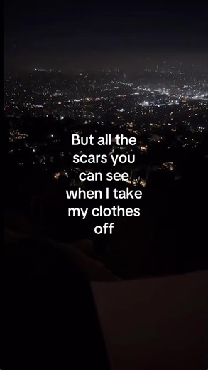 Under Your Spell: Embracing Scars and Self-Acceptance