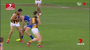 This is the only hand-held brain scanner in the world. www.7NEWS.com.au #7NEWS | 7NEWS Melbourne