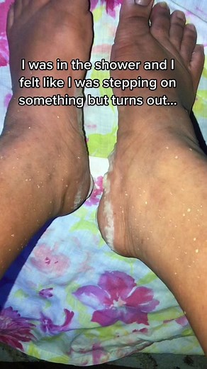 Ty👽 (@tythemisfit)’s video of foot peel masks