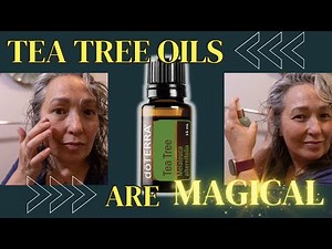 What Are The Benefits of The Tea Tree Essential Oil (Best Uses, Health Benefits, and More)