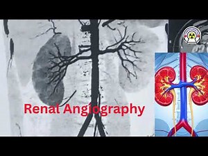 RTENAL ANGIOGRAPHY #RenalAngiography #Radiology #MedicalLearning #KidneyScan #Radiology of student