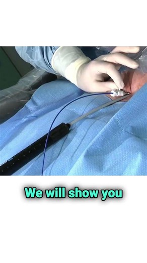 PVI made simple with balloon-in-basket technology!