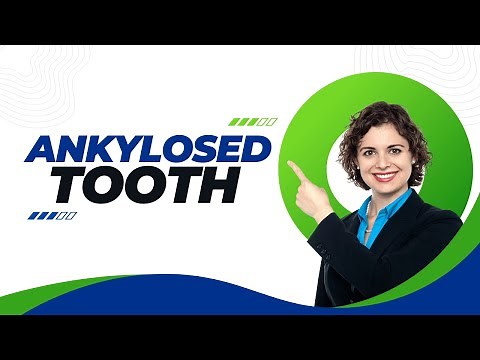 Ankylosed Tooth: Signs, Symptoms, and Cure