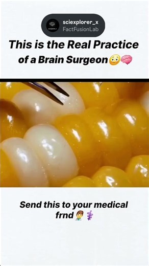 brain surgery #reels #physics #universe #viral #shorts #shortsfeed #biology #neuroscience #facts