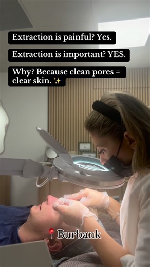 EsterdeEsthetic• Signature Facials .Hydrofacials Burbank | #Nobody loves extractions… But everybody loves the results. Extraction is the process of removing clogged pores — like blackheads,... | Instagram