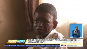 8.8K views · 373 reactions | FATHER TO KAUNDA SQUARE BOY WITH RARE SKIN DISEASE APEAL FOR HELP.. Contact hope tv zambia for more information | Emblem | Facebook