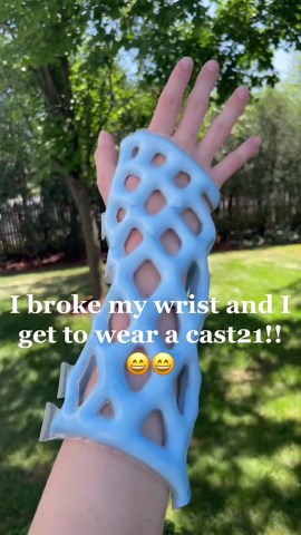 Why Breaking Your Wrist for a Cast21 Product Isn't Worth It