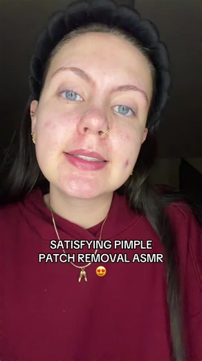 Satisfying Pimple Patch Removal ASMR Experience
