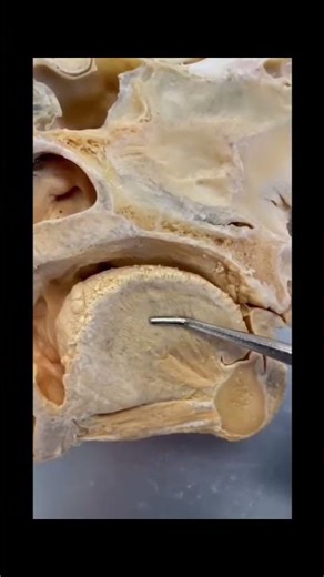 “Tongue Anatomy for Physiotherapy Students 💪🧠”Genioglossus, Hyoglossus, Styloglossus Explained!”