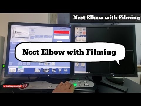 NCCT Elbow Protocol Explained — Positioning, FOV, AP/LAT Topo, MPR & 3D Reconstructions.