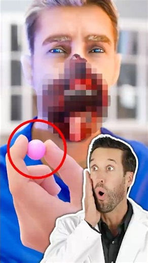 ER Doctor REACTS to Chewing Gum Explosion Kills Student (Zack D. Films)