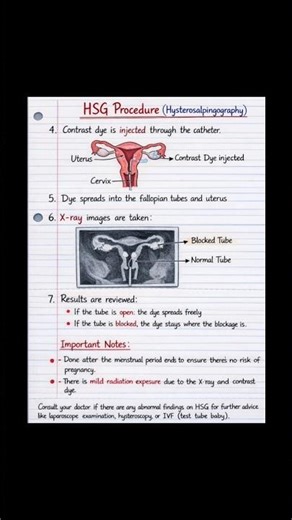 HSG Procedure Notes | Easy Explanation #radiology #viralshorts #trendingshorts #medicalimaging #xray