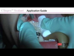 Henry Schein UK - 3M ESPE Clinpro Sealant Application Guide