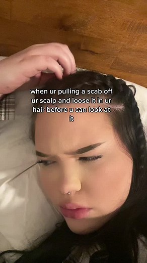 Scab Pulling Compilation: Relatable Moments