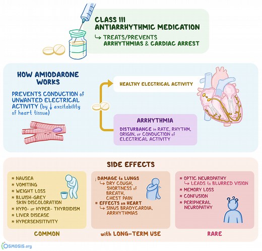 Amiodarone: What Is It, How Does It Work, What Is It Used For | Osmosis