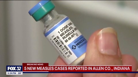 Five new cases of measles reported in Allen County, Indiana