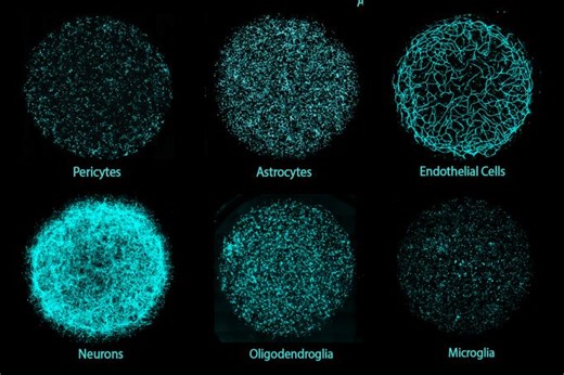 MIT invents human brain model with six major cell types to enable personalized disease research, drug discovery