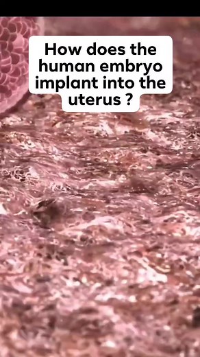 826K views · 4.3K reactions | How does the human embryo implant into the uterus ? Failure is just one cause of failed IVF #embryo #infertility #ivf #implantation #ttc #infertilityjourney #faliedivf #IVFFailure #ivfjourney #goldcoastivf | Steven Palter | Facebook
