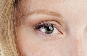 Eyelid Surgery: What to Expect, Recovery, Results | RealSelf