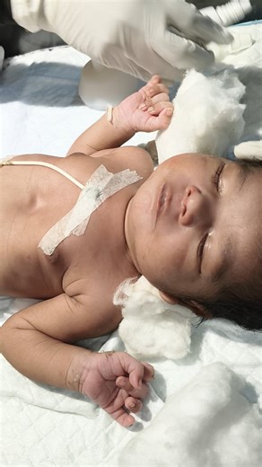 new baby being chestryp in nicu 😘🥰😇#youtubeshorts #newbornbaby #baby #nursing #workout #viralshort