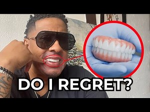 Do I Regret My Dental Implants? (1 Year Later - Honest Review)