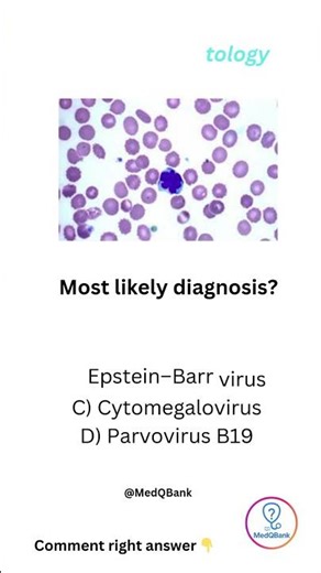 🩸 Atypical Lymphocytes on Smear ❓ Guess the Infection! | #MedQuiz