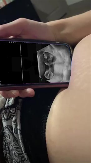 Comprehensive Guide to Understanding Your Pregnancy