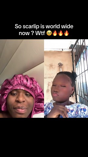 Scarlip Phenomenon Explained