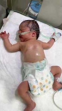 Fighting for Breath: Stabilizing a Newborn with Critical Respiratory Distress #firstbreath #breath