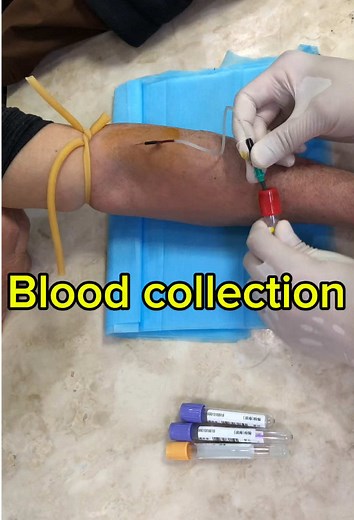 Phlebotomist Collecting Blood Sample: Step-by-Step Guide
