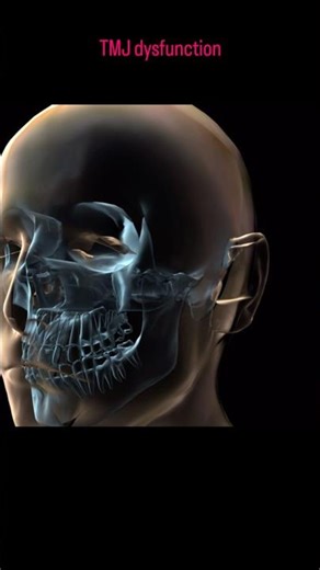 TMJ dysfunction ✅#subscribe #anatomy #physiotherapist #youtubeshorts #tmjpain