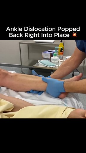 Lavia Health on Instagram: "Dislocated ankle popped back into place  Please note: This is not intended as medical advice, diagnosis or treatment. Always check with a health care professional."