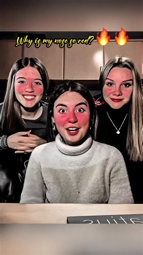 🔥How to make a red nose filter🔥 How to create a sensitive-skin filter effect🔥 How to make a natural blush glow🔥 How to create a natural cheek-blush look Why is my nose so red?🍓 Want to create this red-nose sensitive-skin natural blush effect?🔥 How to make a red nose filter🔥 How to create a sensitive-skin filter effect🔥 How to make a natural blush glow🔥 How to create a natural cheek-blush look #capcutforus#fyp#capcut #capcutpioneer