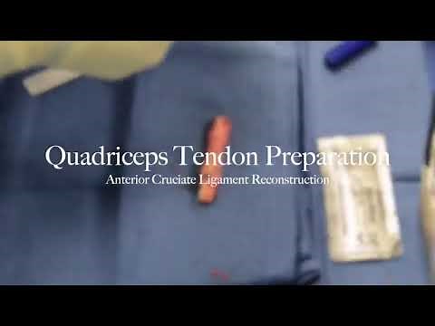 ACL Reconstruction with Quadriceps Tendon Autograft Step by Step Preparation