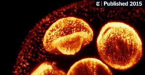 Birth? Trivial Next to Cellular Doughnut-Making Process