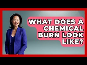 What Does A Chemical Burn Look Like? - First Response Medicine