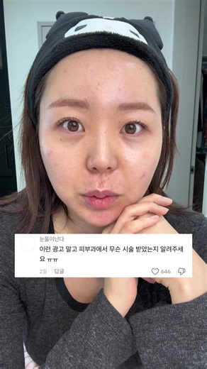 피부과 시술 후기와 효과 공유