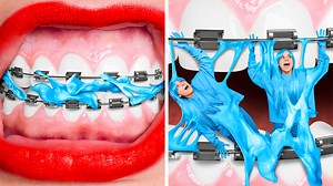 Me vs braces - crazy beauty teen struggles| funny awkward relatable situations by 123go! challenge: | 123 GO Challenge
