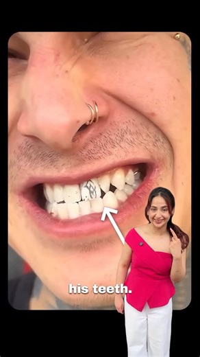 Perfora® on Instagram: "Tattoos… on your TEETH?! 👀 Welcome to Teeth Trends - your go-to for the quirkiest oral beauty trends around the globe!🤭🌏 Yep, Tattooth aka tattoos for your teeth are real and it’s trending. And we have got you all covered 💜 Would you get this done? 🤭 . . . #TeethTrends #ToothTattoo #TrendAlert #Beauty #Tattoos #TeethTok #GenZ #ToothGems #UnusualTrends #TikTokTrend #GlowUp #PopularTrends #Style #Beauty #Dental #Inked #Aesthetic #Trendy [tooth tattoo, teeth tattoos, de